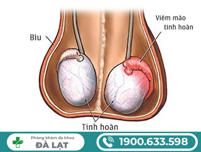 Hình ảnh minh họa